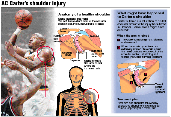 injury info-graphic