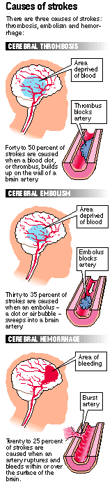 Info graphic